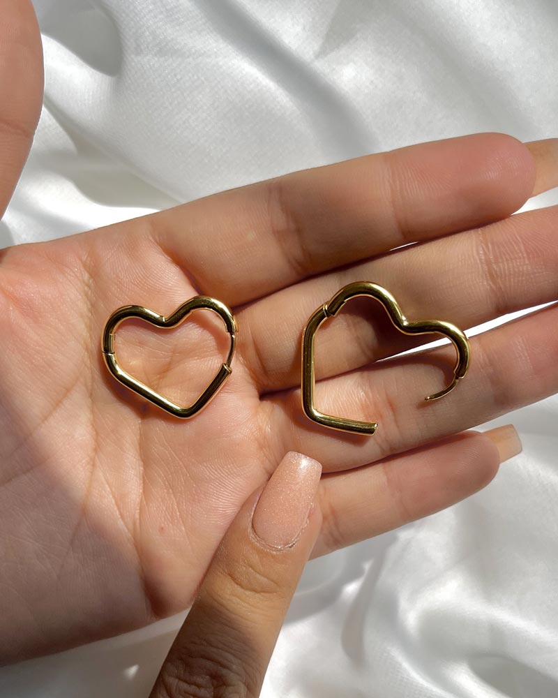 Aretes